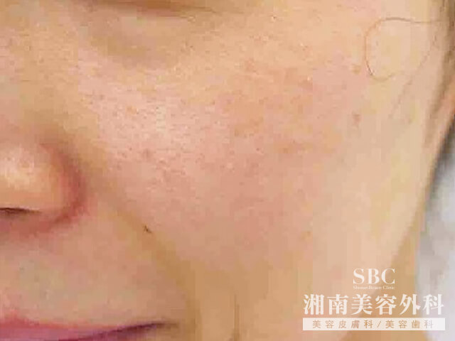 脸部皱纹 面部皱纹 面部皱纹english 面部皱纹的英语 Www Dingjisc Com 脸部皱纹 面部皱纹 面部皱纹english 面部皱纹的英语 Www Dingjisc Com