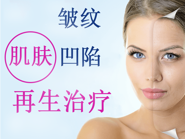 黑眼圈 眼睛下方的凹陷 根据烦恼检索 湘南美容医院官方网站 黑眼圈 眼睛下方的凹陷 根据烦恼检索 湘南美容医院官方网站