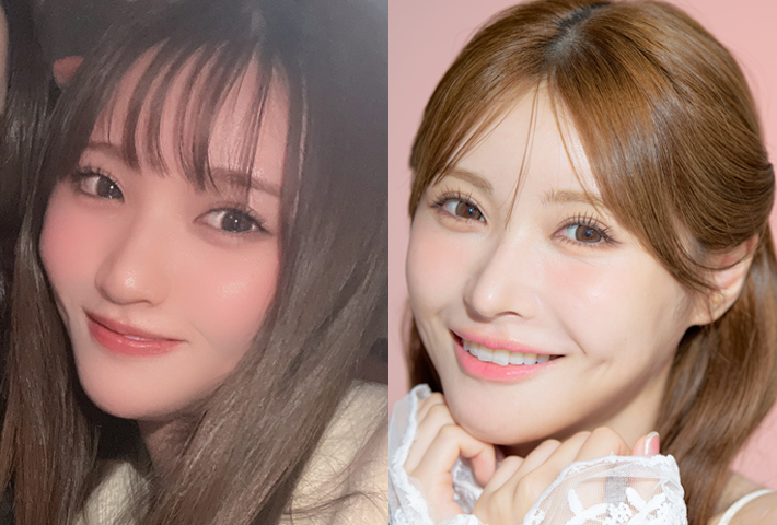 Before After 症例1