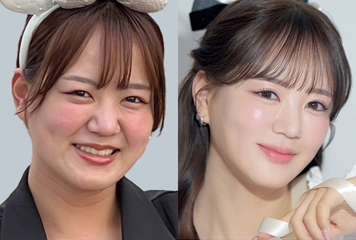 Before After 症例8