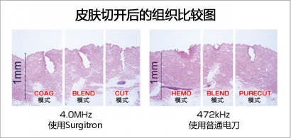 皮膚切開による組織比較