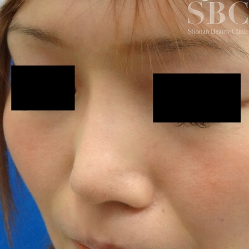 症例写真