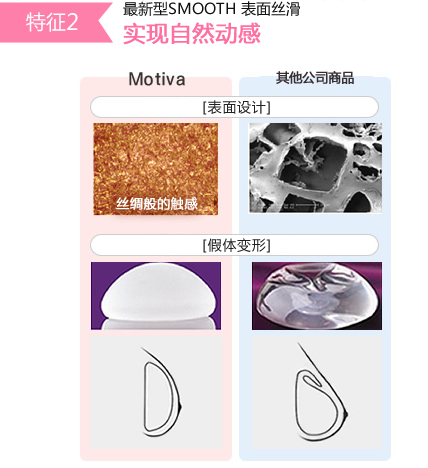 特徴2