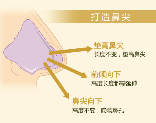 鼻中隔延長術の特徴