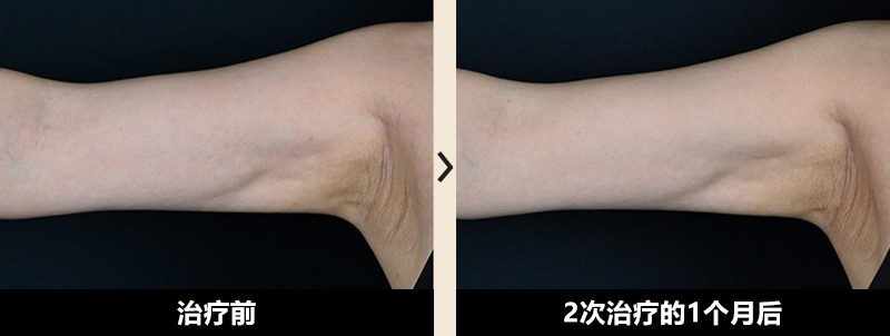 症例写真 Before After