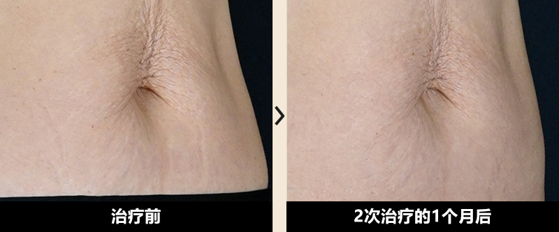 症例写真 Before After