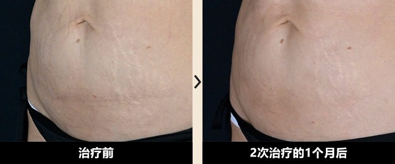 症例写真 Before After