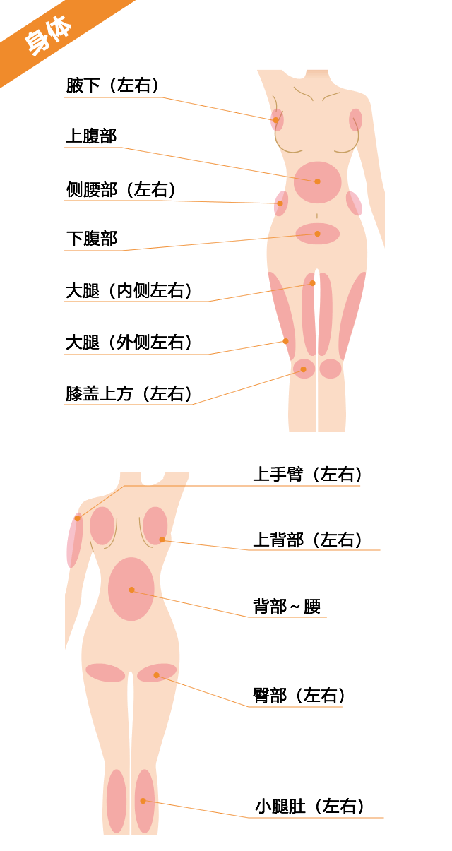 ボディ