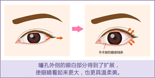 瞳の外側に白目部分が広がり、目を大きく見せ、優しい印象を与えます。