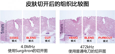 皮膚切開による組織比較