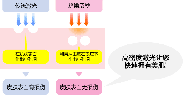 高密度レーザーによる最小限のダウンタイムで美肌へ!