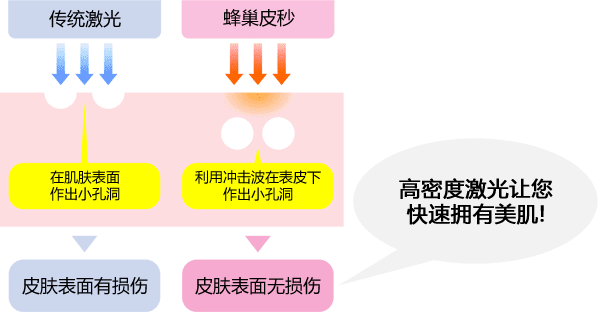 高密度レーザーによる最小限のダウンタイムで美肌へ！