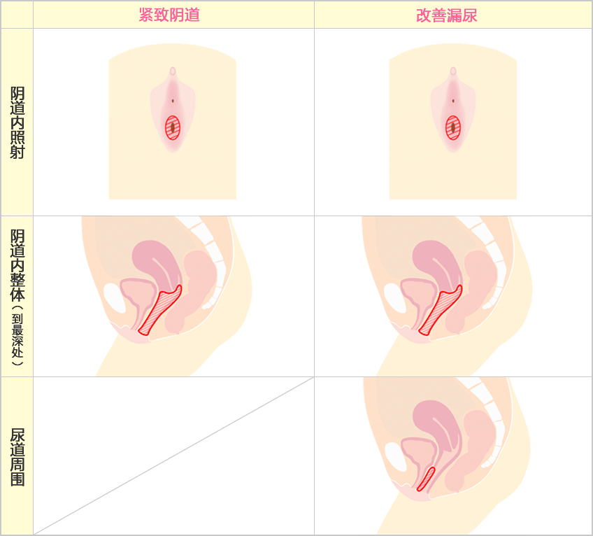 照射范围