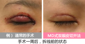 症例写真
