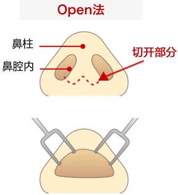 オープン法